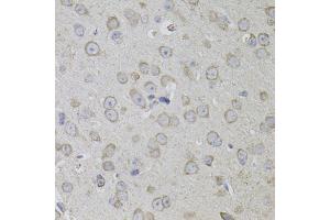 Immunohistochemistry of paraffin-embedded mouse brain using CD59 antibody.