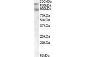 Western Blotting (WB) image for anti-CUB Domain Containing Protein 1 (CDCP1) (C-Term) antibody (ABIN2465191) (CDCP1 抗体  (C-Term))
