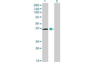 Western Blotting (WB) image for anti-POU Class 6 Homeobox 1 (POU6F1) (AA 193-301) antibody (ABIN562327)