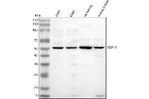 Western blot analysis of IGSF11 using anti-IGSF11 antibody (ABIN7602301).