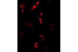 Immunofluorescent analysis of Nop30 staining in U2OS cells. (NOL3 抗体)