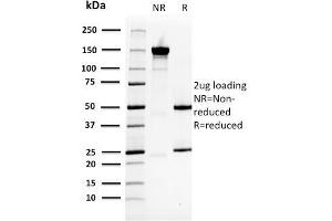 SDS-PAGE Analysis Purified HSP27 Mouse Monoclonal Antibody (CPTC-HSPB1-2). (HSP27 抗体)