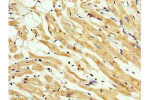 IHC image of ABIN7159457 diluted at 1:200 and staining in paraffin-embedded human heart tissue performed on a Leica BondTM system. (Cyclin M3 抗体  (AA 358-645))