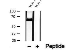 Western blot analysis of extracts of MCF-7 cells, using NR1D1 antibody. (NR1D1 抗体  (N-Term))