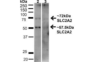 Western blot analysis of Human HeLa and HEK293T cell lysates showing detection of ~57. (SLC2A2 抗体  (C-Term) (PE))