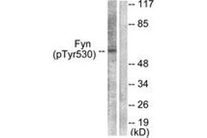 Western blot analysis of extracts from 293 cells treated with H2O2 100uM 15', using Fyn (Phospho-Tyr530) Antibody. (FYN 抗体  (pTyr531))