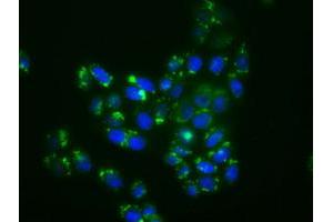 Image no. 2 for anti-Mitogen-Activated Protein Kinase 11 (MAPK11) antibody (ABIN1500806)
