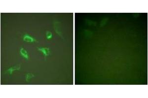 Immunofluorescence analysis of HeLa cells, using 14-3-3 zeta (Ab-58) Antibody. (14-3-3 zeta 抗体  (AA 24-73))
