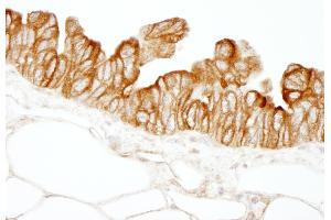 Immunohistochemistry (IHC) image for anti-Host Cell Factor C1 Regulator 1 (XPO1 Dependent) (HCFC1R1) (AA 1-50) antibody (ABIN7448976)