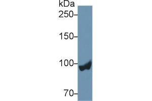 Western blot analysis of Rat Liver lysate, using Rat PYGL Antibody (2 µg/ml) and HRP-conjugated Goat Anti-Rabbit antibody ( (PYGL 抗体  (AA 73-267))