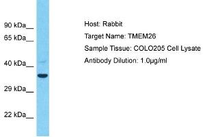 Host: Rabbit Target Name: TMEM26 Sample Type: COLO205 Whole Cell lysates Antibody Dilution: 1. (TMEM26 抗体  (C-Term))