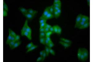 Immunofluorescence staining of HepG2 cells with ABIN7159657 at 1:100, counter-stained with DAPI. (MMADHC 抗体  (AA 26-142))