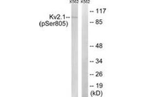 Western blot analysis of extracts from K562 cells treated with TNF 200ng/ml 30', using Kv2. (Kv2.1/KCNB1 抗体  (pSer805))