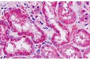 Human Kidney: Formalin-Fixed, Paraffin-Embedded (FFPE) (EFNA4 抗体  (AA 131-180))