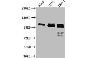 Western Blot Positive WB detected in: K562 whole cell lysate, U-251 whole cell lysate, THP-1 whole cell lysate All lanes: ITCH antibody at 1:1000 Secondary Goat polyclonal to rabbit IgG at 1/50000 dilution Predicted band size: 103, 99, 87 kDa Observed band size: 103 kDa