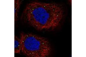 Immunofluorescent staining of human cell line A-431 with PATL1 polyclonal antibody  at 1-4 ug/mL dilution shows positivity in vesicles.