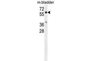CTSA Antibody (N-term) western blot analysis in mouse bladder tissue lysates (35µg/lane). (CTSA 抗体  (N-Term))