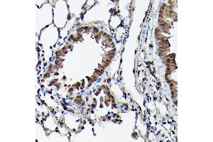 Immunohistochemistry (IHC) image for anti-Ataxin 3 (ATXN3) (AA 1-364) antibody (ABIN3021829)