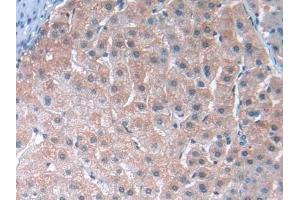 DAB staining on IHC-P; Samples: Human Liver Tissue (TUBE1 抗体  (AA 236-473))