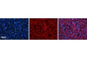 Rabbit Anti-HERC4 Antibody   Formalin Fixed Paraffin Embedded Tissue: Human Liver Tissue Observed Staining: Cytoplasm in hepatocytes Primary Antibody Concentration: N/A Other Working Concentrations: 1:600 Secondary Antibody: Donkey anti-Rabbit-Cy3 Secondary Antibody Concentration: 1:200 Magnification: 20X Exposure Time: 0. (HERC4 抗体  (Middle Region))