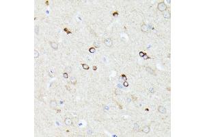 Immunohistochemistry of paraffin-embedded rat brain using CCDC6 antibody (ABIN7266442) at dilution of 1:100 (40x lens). (CCDC6 抗体  (AA 55-222))