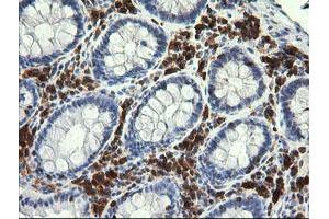 Image no. 1 for anti-Phosphoinositide-3-Kinase, Catalytic, gamma Polypeptide (PIK3CG) antibody (ABIN1500202) (PIK3 gamma 抗体)