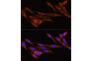 Immunofluorescence analysis of NIH/3T3 cells using  Rabbit pAb (ABIN7269965) at dilution of 1:100. (ARHGAP30 抗体  (AA 485-585))