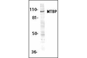 Western blot analysis of MTBP expression in K562 whole cell lysates with this product at 1 μg /ml. (MTBP 抗体  (Middle Region))
