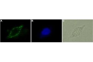 Expression of CB2 receptor in human LNCaP - Immunocytochemical staining of living human prostate carcinoma cells (LNCaP). (CNR2 抗体  (Extracellular, N-Term))
