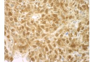 Immunohistochemistry (IHC) image for anti-Eukaryotic Translation Initiation Factor 4E Binding Protein 1 (EIF4EBP1) (C-Term) antibody (ABIN7448395) (eIF4EBP1 抗体  (C-Term))
