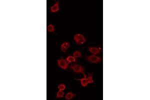 ABIN6275340 staining Hela by IF/ICC. (ZDHHC15 抗体  (C-Term))