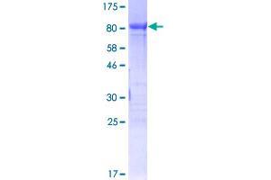 FOXC2 Protein (AA 1-501) (GST tag)