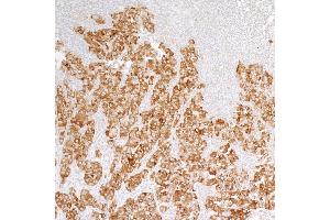 anti-Protein Tyrosine Phosphatase G1 (PTPN12) (AA 499-780) antibody
