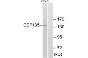 Western blot analysis of extracts from COLO cells, using CEP135 antibody. (CEP135 抗体  (C-Term))