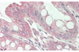 Detection of JAG1 in Human Colon Tissue using Polyclonal Antibody to Jagged 1 (JAG1) (JAG1 抗体  (AA 836-1047))