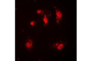 Immunofluorescent analysis of SKP2 staining in HeLa cells. (SKP2 抗体  (C-Term))