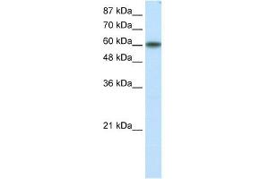 WB Suggested Anti-KLF11 Antibody Titration: 1. (KLF11 抗体  (N-Term))