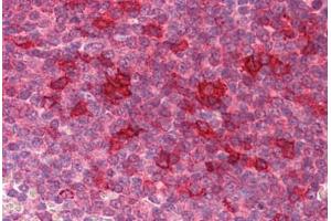 Human Spleen: Formalin-Fixed, Paraffin-Embedded (FFPE) (KLHL25 抗体  (Internal Region))