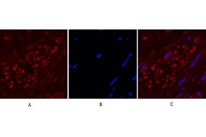 Immunofluorescence analysis of human appendix tissue. (ENO2/NSE 抗体)