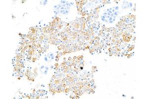 Immunohistochemistry (IHC) image for anti-Mannose Receptor, C Type 1 (MRC1) (AA 1406-1456) antibody (ABIN7455101)
