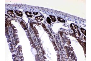 Immunohistochemistry (IHC) image for anti-RAN, Member RAS Oncogene Family (RAN) (AA 2-216) antibody (ABIN5518950)