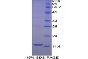 SDS-PAGE analysis of Human Histatin 1 Protein. (HTN1 蛋白)