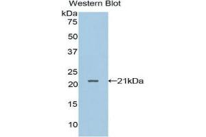 Western Blotting (WB) image for anti-Leukocyte Cell-Derived Chemotaxin 2 (LECT2) (AA 1-151) antibody (ABIN3203619) (LECT2 抗体  (AA 1-151))