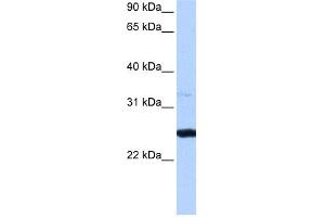 WB Suggested Anti-PRTFDC1 Antibody Titration:  0. (PRTFDC1 抗体  (Middle Region))