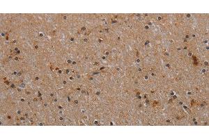 Immunohistochemistry of paraffin-embedded Human brain tissue using p70 S6 kinase beta Polyclonal Antibody at dilution 1:40 (RPS6KB2 抗体)