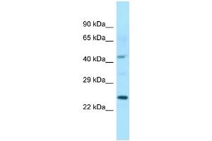 WB Suggested Anti-ISOC1 Antibody Titration: 1. (ISOC1 抗体  (C-Term))