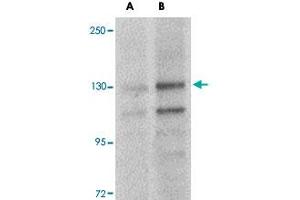 Western blot analysis of FRMPD4 in SK-N-SH cell lysate with FRMPD4 polyclonal antibody  at (A) 1 and (B) 2 ug/mL .