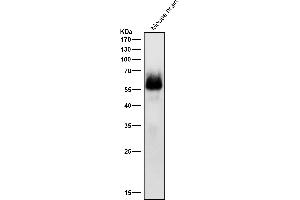 All lanes use the Antibody at 1:1k dilution for 1 hour at room temperature.