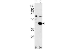 Western Blotting (WB) image for anti-Pyruvate Dehydrogenase Kinase, Isozyme 2 (PDK2) antibody (ABIN3002951) (PDK2 抗体)