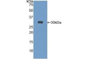Detection of Recombinant Protein RPB837Mu01 with S-tag using Anti-S15 Oligopeptide (S) Tag Polyclonal Antibody (S15 Oligopeptide 抗体)